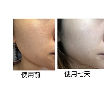 chasiutung-L'ORÉAL PARiS超水光精華乳_2