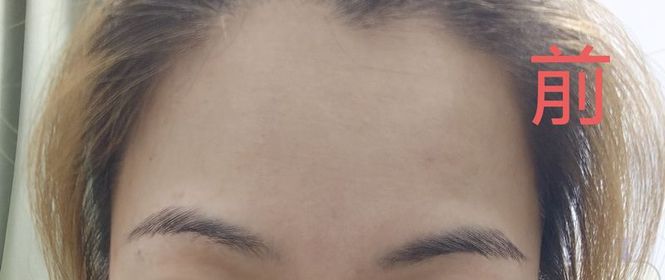Erica -L'ORÉAL PARiS超水光精華_3