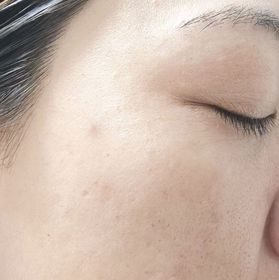 Erica -L'ORÉAL PARiS超水光精華乳_2