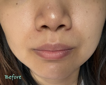 Selena-L'ORÉAL PARiS超水光精華_2