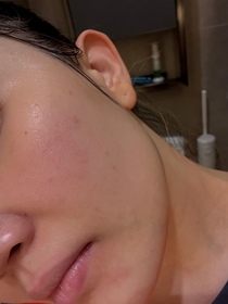 Sharon-JOSERISTINE 彩豐12杯水啫喱保濕精華噴霧_2