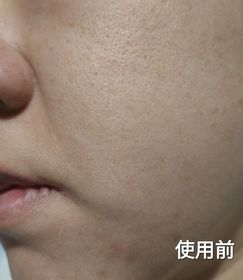 lovemon222-JOSERISTINE 彩豐神經醯胺透明質酸12杯水滋潤啫喱_3