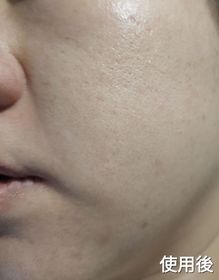 lovemon222-JOSERISTINE 彩豐神經醯胺透明質酸12杯水滋潤啫喱_4