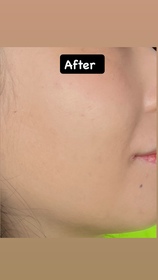yingtang1999-SHISEIDO 資生堂養膚柔霧修護精華粉底 SPF30 PA+++ _2