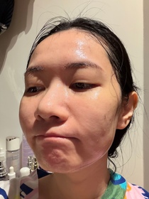 Mandy-MEDIHEAL積雪草特強修護精華水庫面膜_3